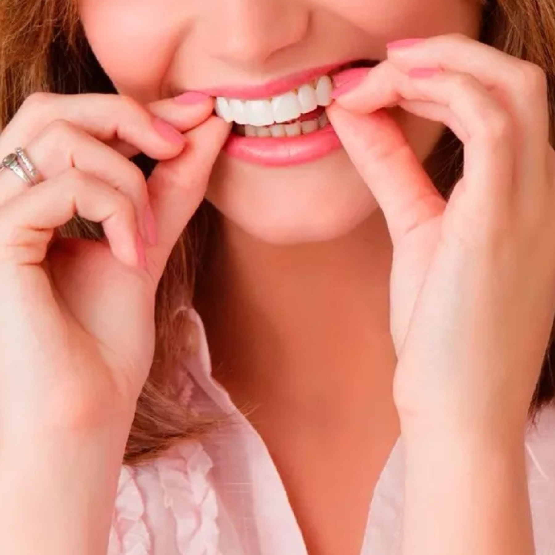 Carillas Postiza Dentadura SnapOn Smile
